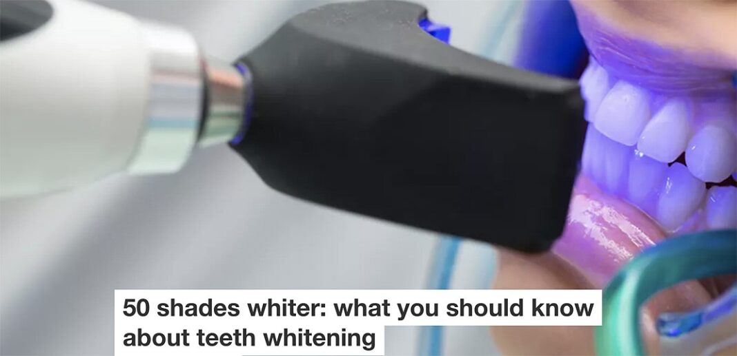 50 shades whiter: what you should know about teeth whitening