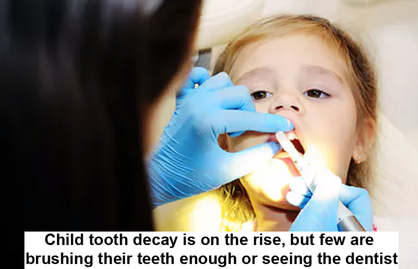 Child Tooth Decay Is On The Rise, But Few Are Brushing Their Teeth Enough Or Seeing The Dentist